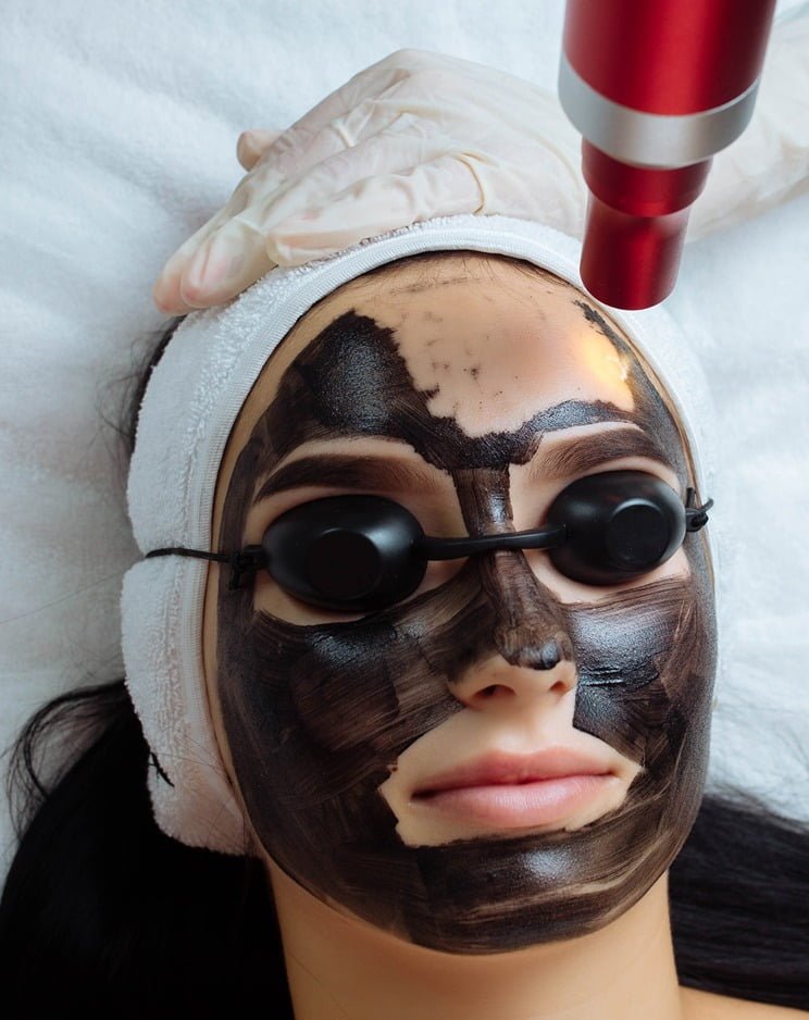 hollywood carbon peel in Pune