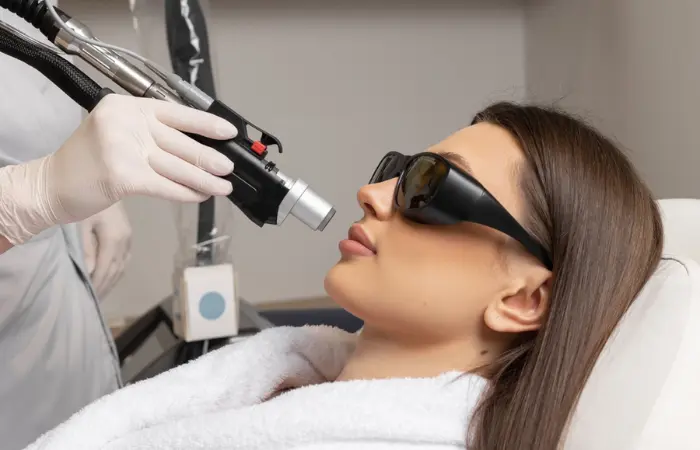 Laser Treatment