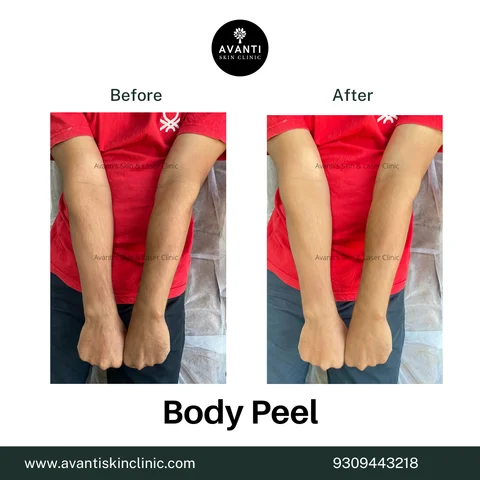 before and after glutathione benefits Glutagem® Glutathione — How It Works & Key Benefits – Glutagem® UK main image 0